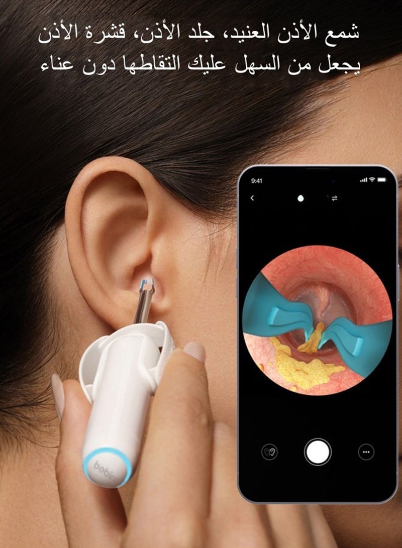 Bebird Home30S Smart Ear Cleaner with Camera for Smart Ear Care for the Modern Family - White - Image 3