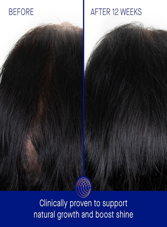 Augustinus Bader The Scalp Treatment - Image 3
