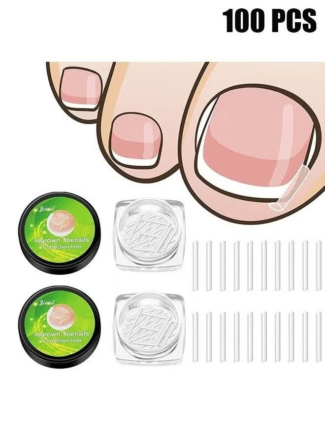 Ingrown Toenail Corrector Strips Toenail Correction Patches Curved Toenails Straightening Recover Clips Thick Paronychia Pedicure Tool Toenail Straightener Strip for Men Women Foot Care 100 Pieces - Image 1