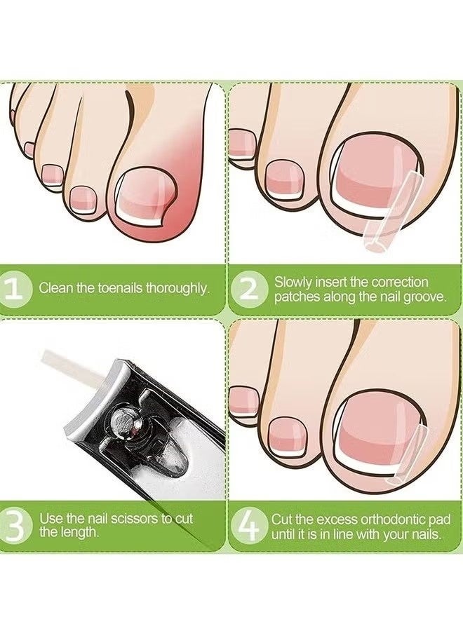 Ingrown Toenail Corrector Strips Toenail Correction Patches Curved Toenails Straightening Recover Clips Thick Paronychia Pedicure Tool Toenail Straightener Strip for Men Women Foot Care 100 Pieces - Image 4