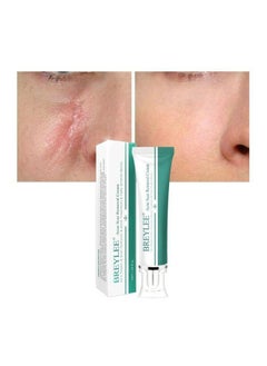Breylee Acne Scar Removal Cream 30grams  - Image 4