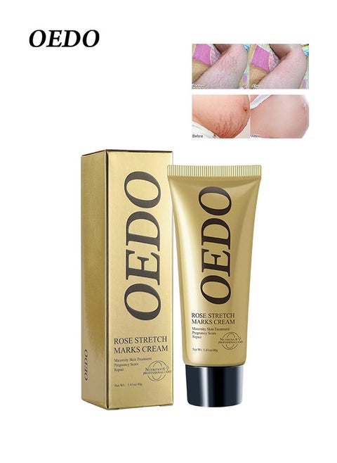 Rose Stretchmarks Cream 40g,  Contains Rose Essence, Can Promote Cell Regeneration, Repair Necrotic Cells and Enhance Skin Elasticity, Designed For Mother's Stretch Marks