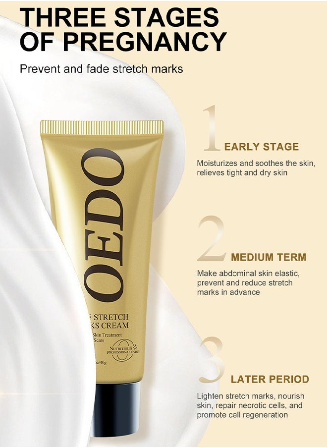Rose Stretchmarks Cream 40g,  Contains Rose Essence, Can Promote Cell Regeneration, Repair Necrotic Cells and Enhance Skin Elasticity, Designed For Mother's Stretch Marks