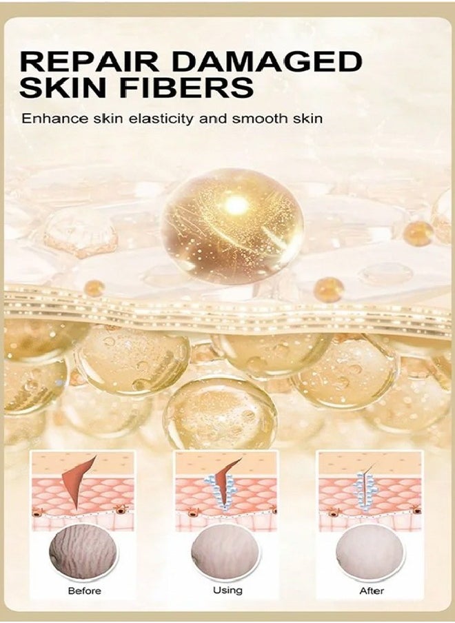 Rose Stretchmarks Cream 40g,  Contains Rose Essence, Can Promote Cell Regeneration, Repair Necrotic Cells and Enhance Skin Elasticity, Designed For Mother's Stretch Marks