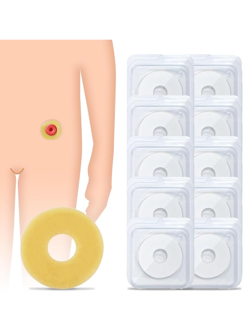 SYOSI 10PCS Ostomy Barrier Rings, Moldable Adapt Barrier Rings, Hydrocolloid Skin Extender Rings for Colostomy Bags, Ostomy Supplies with 2" (48mm) Outer Diameter - Image 1