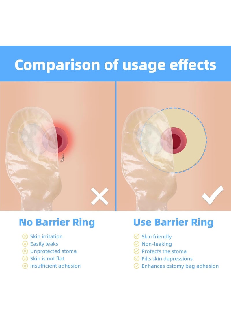 SYOSI 10PCS Ostomy Barrier Rings, Moldable Adapt Barrier Rings, Hydrocolloid Skin Extender Rings for Colostomy Bags, Ostomy Supplies with 2" (48mm) Outer Diameter - Image 3
