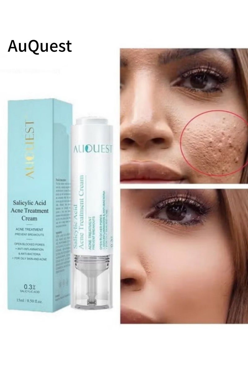 AuQuest Salicylic Acid Acne Treatment Cream – 15ml Whitening & Blackhead Removal Face Cream with Hyaluronic Acid | Skin Repair & Brightening Essence - Image 1