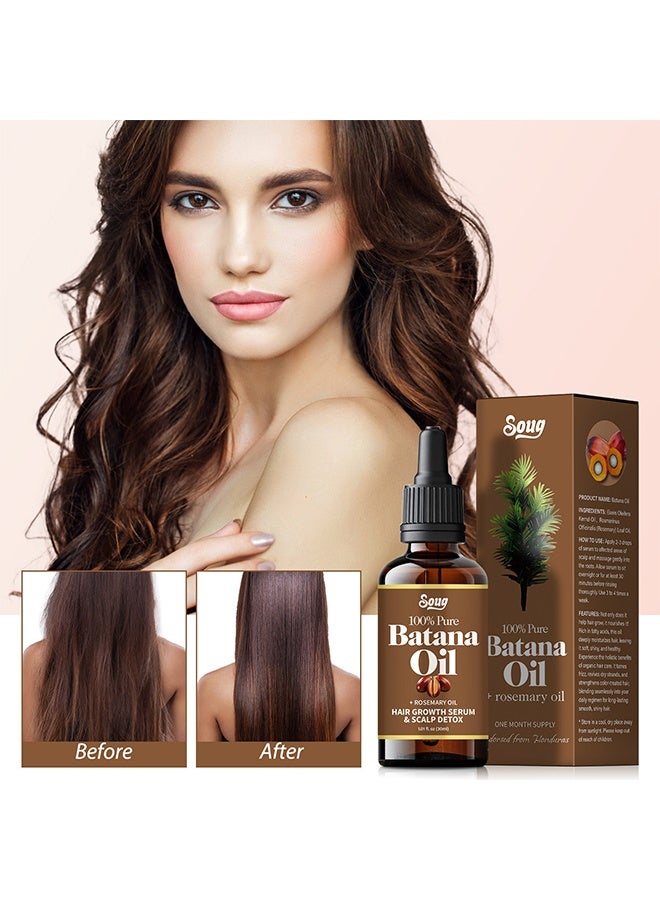 SOUG Batana Oil+Rosemary Oil Hair Growth Serum - Nourish Scalp & Detox for Strong & Healthy Hair 100% Organic Batana Oil from Honduras with Rosemary - Reduce Hair Loss & Detox Your Scalp 30ml - Image 2