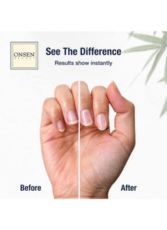 Onsen Secret Onsen Cuticle Cream W/Nail Cuticle Oil Cuticle Softener With Japanese Natural Healing Minerals Nail Care Serum To Soothe Repair & Strengthen Cuticles And Nails Visible Results (2 Count /15 Ml)  - Image 2