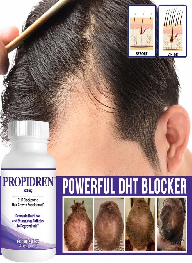 Pronexa Propidren DHT Blocker & Hair Growth Pills To Stop Hair Loss and Regrow Hair - Image 3