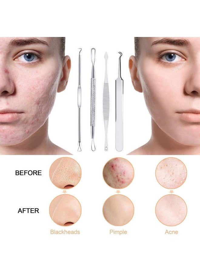 MENOLY - Pimple Popper Tool Kit 10 Pcs Blackhead Remover Zit Popper Tools For Blemish Pimple Comedone Extractor Acne Tool For Nose Face With A Leather Bag - Image 1