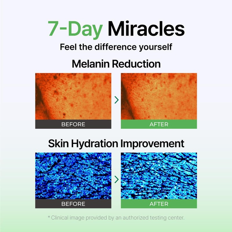 IZEZE Exosome PDRN Booster Ampoule, Pore Minimizing & Firming, Cica Exosomes for Skin, Korean Skin Care PDRN 6000 ppm, Plant-Based Exosome, 1.01 fl.oz - Image 5