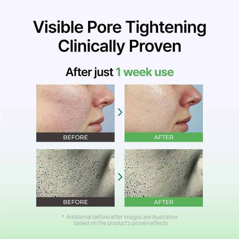 IZEZE Exosome PDRN Booster Ampoule, Pore Minimizing & Firming, Cica Exosomes for Skin, Korean Skin Care PDRN 6000 ppm, Plant-Based Exosome, 1.01 fl.oz - Image 4