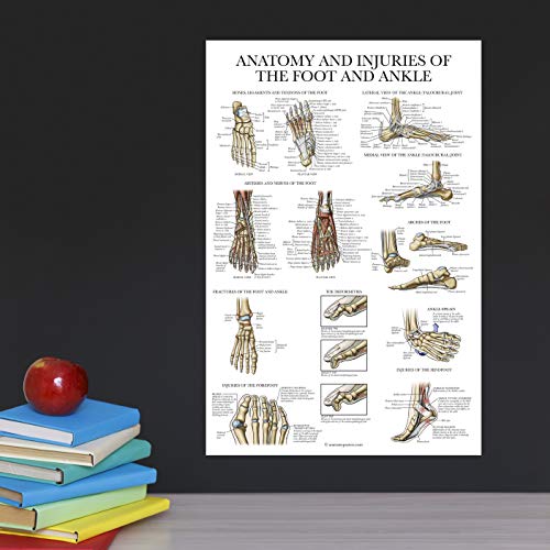 Palace Learning 2 Pack - Anatomy and Injuries of the Hand & Wrist + Anatomy and Injuries of the Foot & Ankle - Set of 2 Anatomical Charts - Laminated 18" x 24" - Image 5