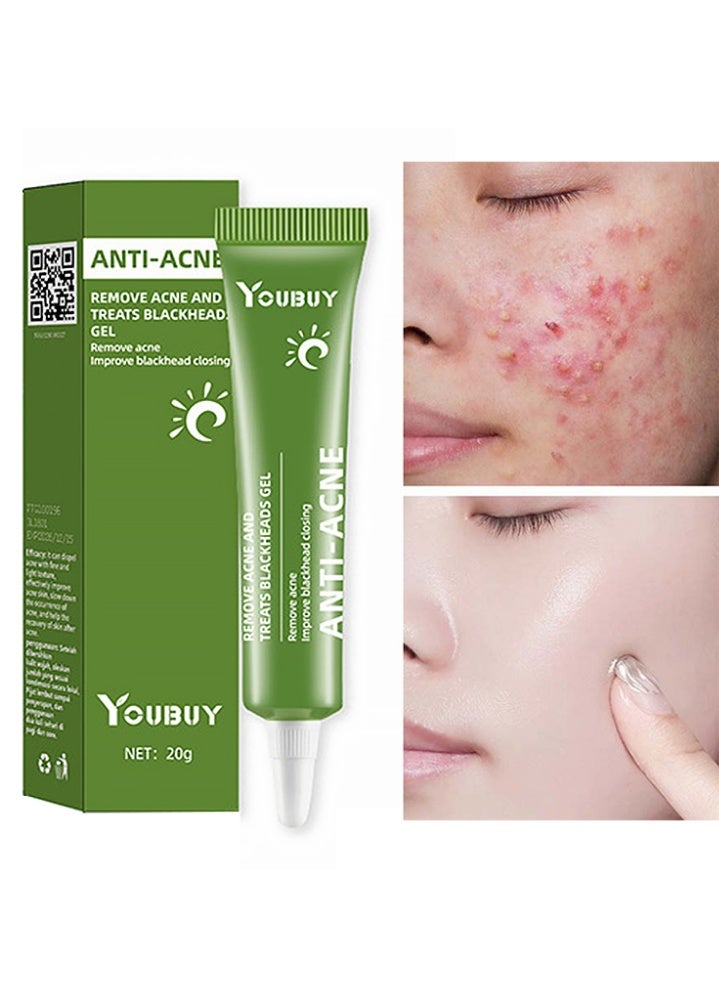 YOUBUY Anti-Acne Remove Acne and Treats Blackheads Gel-Day Use Remove Acne Pimple and Treats Blackhead with Azelaic Acid Oil Control Shrink Pores Redness Relief Skin Lightening Scar Fade Cream Acne Remover Cream 20g - Image 1
