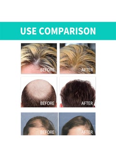 OUHOE Nmn Hair Growth Roller,Thick Hair Roller Essence, Hair Root Thick Hairline Strengthening,Hair Care Firming,Hair Anti Fall Hair Essence 18ml  - Image 3