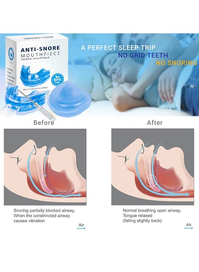 OceAura Anti-Snoring Mouth Guard Adjustable Mouthpiece Night Time Teeth Mouthguard Sleeping Bite Guard For Bruxism And Stop Snoring Custom Molding Adjustability, Snoring Reduction Aid For Men And Women - Image 4
