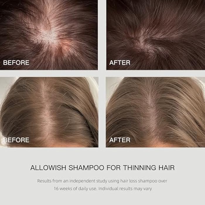 Hair Loss Shampoo for Thinning Hair with Biotin Ginger | Rosemary Shampoo for Hair Growth & Healthy Hair Thickening & Strengthening, Hydrating, Volumizing - Image 3
