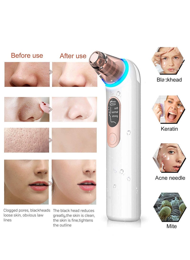 Generic - Blackhead Remover Pore Vacuum with 4 Replaceable Probes,USB Rechargeable ,Comedone Whitehead Extractor, LED Display, Upgraded Blue Light - Image 1