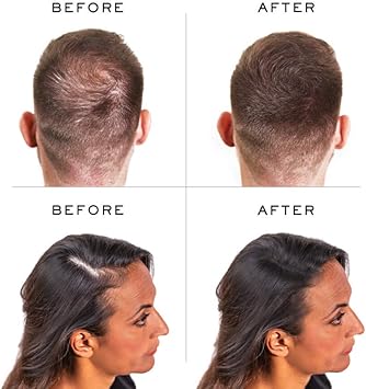 Nanogen Instant Thickening Hair Fibres Light Brown 30g Natural Keratin fibers cover thinning hair and hair loss extensions alopecia thicker fuller hair instantly Pack of 2 - Image 4