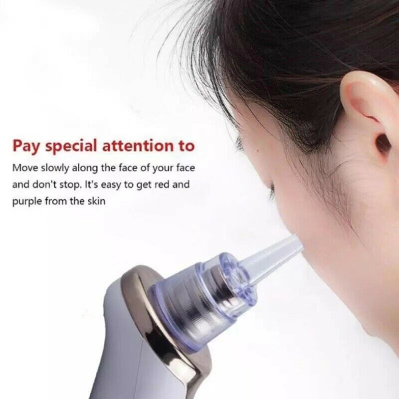 Blackhead Remover 5 Adjustable Suction Levels 5 Suction Heads Pore Cleaner - Non-Invasive Exfoliation Gentle Vacuum Massage Skin Exfoliator for All Skin Types Facial Care - Image 4