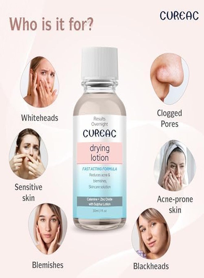 Salve Cureac Drying Lotion with Calamine, Zinc Oxide & Sulphur - 30ml (Pack of 3) | Acne & Spot Care Lotion for Clear & Balanced Skin - Image 3