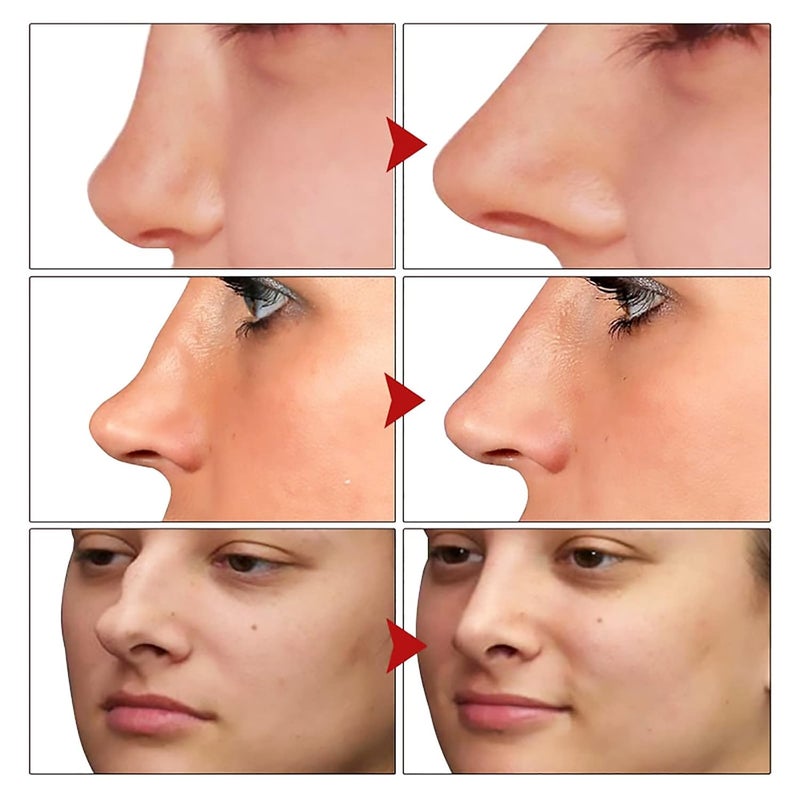 klarako Nose Lift Up Essential Oil, Natural Plant Tightening Massage Oils, Nose Repair Essence Oil, Nose Massage Essential Oil - Image 3