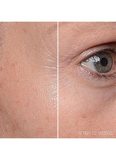 MD Complete by Dr. Brian Zelickson MD Complete Total Eye Treatment | Anti-Aging Hydrating Skin Renewal Eye Treatment | with Peptides, Vitamins C & E and Hyaluronic Acid for Wrinkles, Fine Lines and Crows Feet 0.5 fl oz  - Image 4