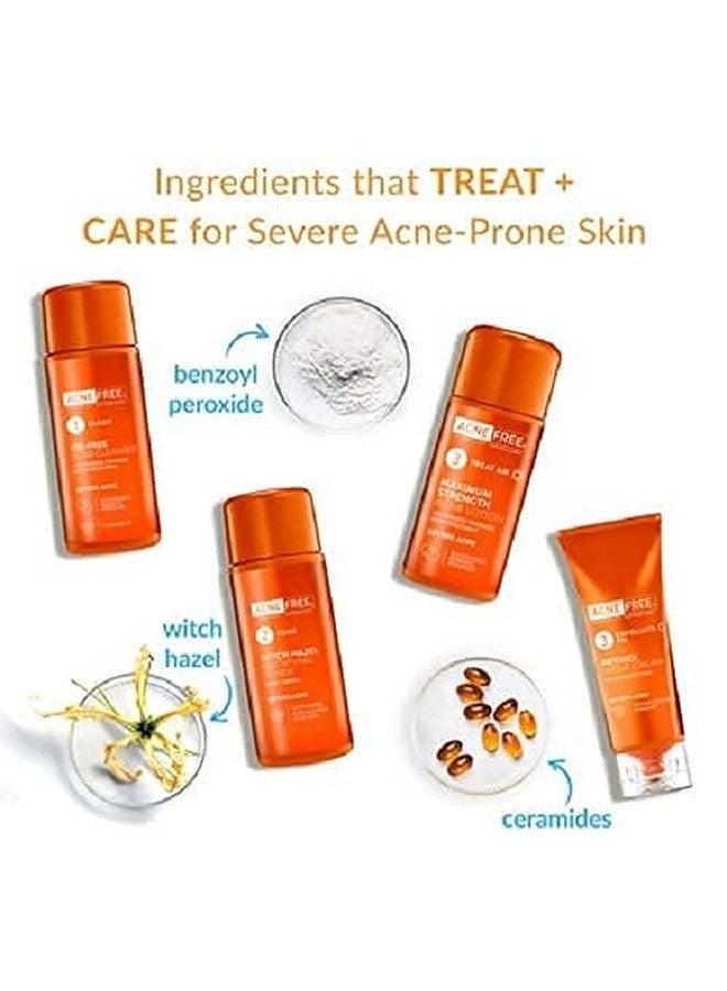 AcneFree Severe Acne Treatment System (2 Pack) - Image 3