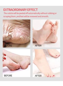 efero Foot Peeling and Exfoliating Mask, Dead Skin Removing Sock - Rose  - Image 5