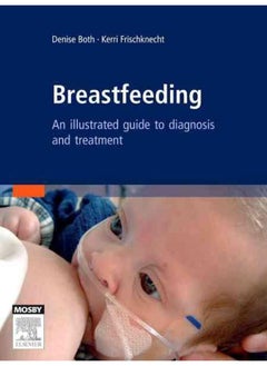 Breastfeeding: An Illustrated Guide To Diagnosis and Treatment 
