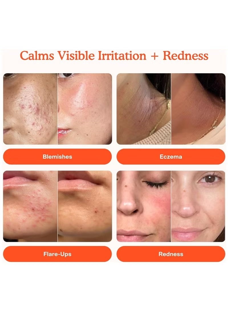 تاور 28 رذاذ الوجه اليومي للإنقاذ SOS. حمض هايبوكلور مصمم للبشرة الحساسة. 4 فلور أوز - Image 5