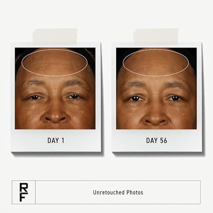 Rodan Fields Rodan + Fields Redefine Pore Minimizing Toner | 4.2 fl oz | Deep Exfoliating Cleanser | Visibly Reduces Blackheads | Formulated with Fruit Acids - Image 2