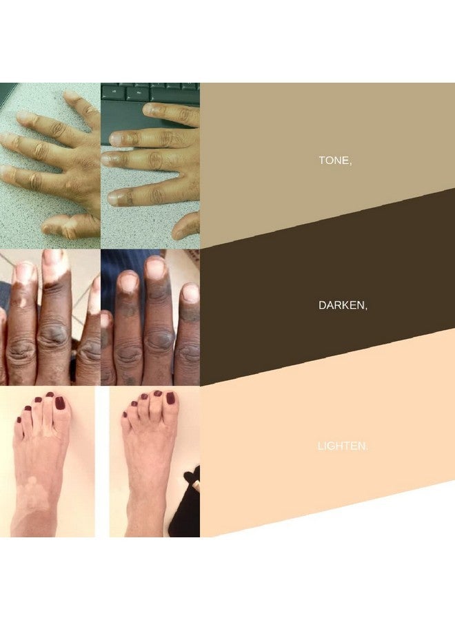 Vitiligo Vanquish Cosmetic Camouflage Kit by Fake Bake Liquid Concealer, Long Lasting Natural Color Customization Eliminates Appearance of Skin Depigmentation For Women & Men - Cover Lasts For Days