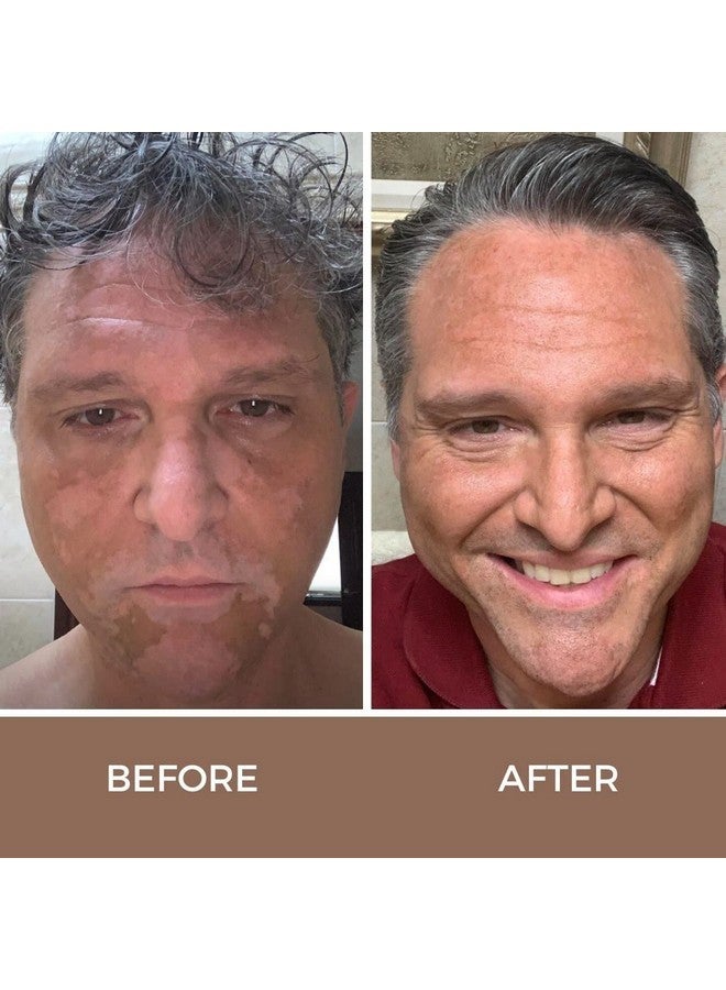 Vitiligo Vanquish Cosmetic Camouflage Kit by Fake Bake Liquid Concealer, Long Lasting Natural Color Customization Eliminates Appearance of Skin Depigmentation For Women & Men - Cover Lasts For Days