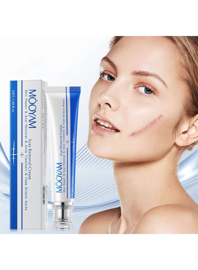 MOOYAM Scar Removal Cream Skin Treatment for Scars Stretch Marks and Acne Marks Improves Skin Texture with Deep Moisturization for All Skin Types - Image 2