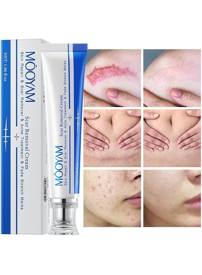 MOOYAM Scar Removal Cream Skin Treatment for Scars Stretch Marks and Acne Marks Improves Skin Texture with Deep Moisturization for All Skin Types - Image 1