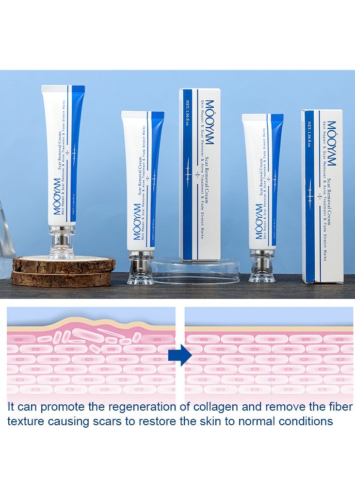 MOOYAM Scar Removal Cream Skin Treatment for Scars Stretch Marks and Acne Marks Improves Skin Texture with Deep Moisturization for All Skin Types - Image 5