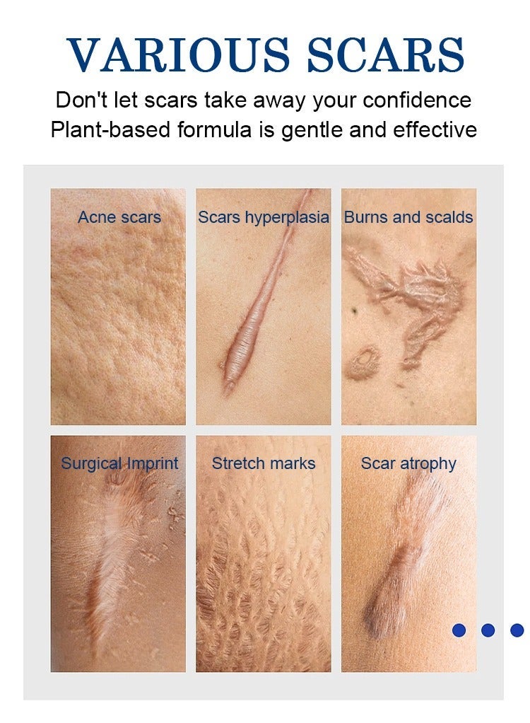 MOOYAM Scar Removal Cream Skin Treatment for Scars Stretch Marks and Acne Marks Improves Skin Texture with Deep Moisturization for All Skin Types - Image 2