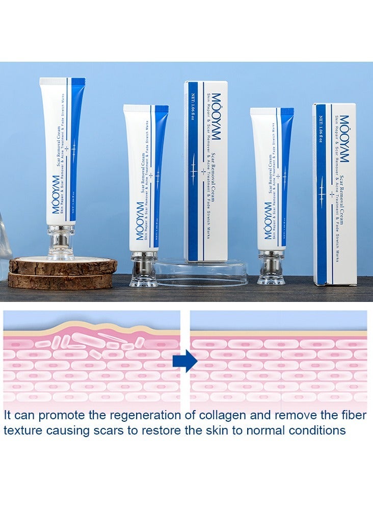 MOOYAM Scar Removal Cream Skin Treatment for Scars Stretch Marks and Acne Marks Improves Skin Texture with Deep Moisturization for All Skin Types - Image 3