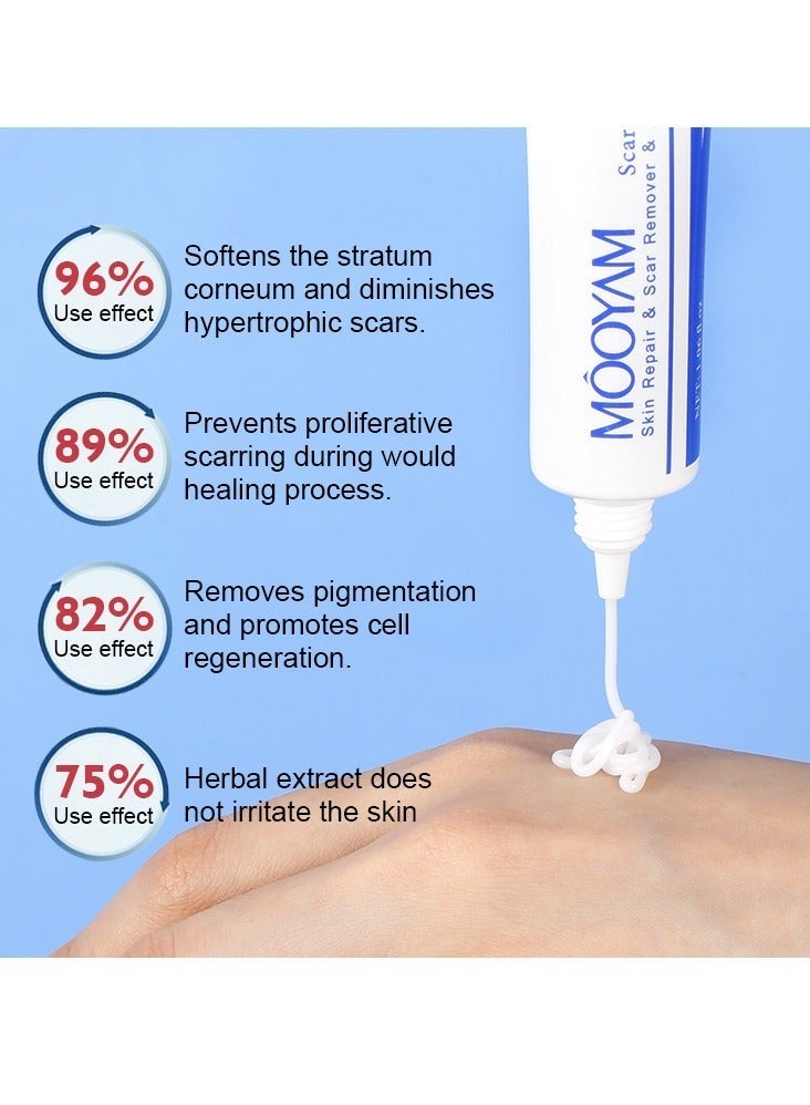 MOOYAM Scar Removal Cream Skin Treatment for Scars Stretch Marks and Acne Marks Improves Skin Texture with Deep Moisturization for All Skin Types - Image 5