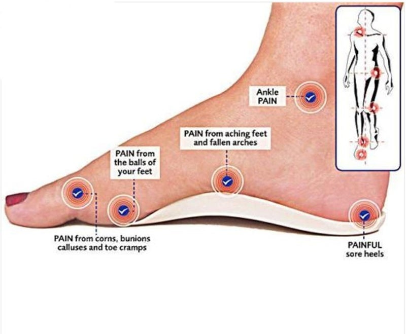 comfrt ® Kids Children Full Length Orthotic Arch Support Insole Shoe Pad Flat Feet Insert Feet Corrector Hallux Valgus Shoe Pad (M (12 cm / 4.72 in)) - Image 5