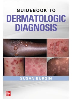 Guidebook to Dermatologic Diagnosis - pzsku/ZD365ED6B18D14537152AZ/45/_/1740733997/2f46f51b-faf4-4fb9-807a-7fd3f96ba7e9