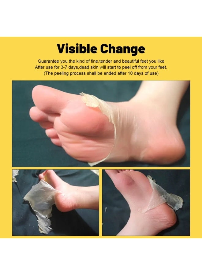 Aichun beauty 2Pcs Banana Foot Peeling Mask Whitening Moisturizing Exfoliating Wearable Sock Type Foot Masks Remove Dead Skin Cells Calluses Softens Peels Off Cuticles Repairs Dry Rough Cracked Feet 2x40G - Image 3