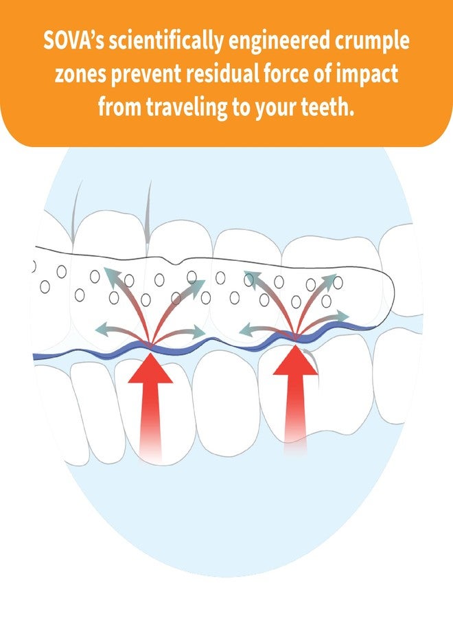 SOVA Junior Night Guard, Snow White - 1.6mm Thin - Custom-Molded Fit - Protects Against Nighttime Teeth Grinding & Clenching - FSA/HSA Eligible - Odor & Taste Free - Remoldable Up to 20 Times - Image 5