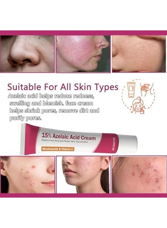 15% AZELAIC ACID ACNE CREAM, ADVANCED AZELAIC ACID SERUM, PREVENTS ACNE BREAKOUTS, CLARIFY SKIN SOOTHE IRRITATION, REDUCES BLEMISHES, MINIMIZES PORES FOR CLEARER AND HEALTHIER FACE - Image 3