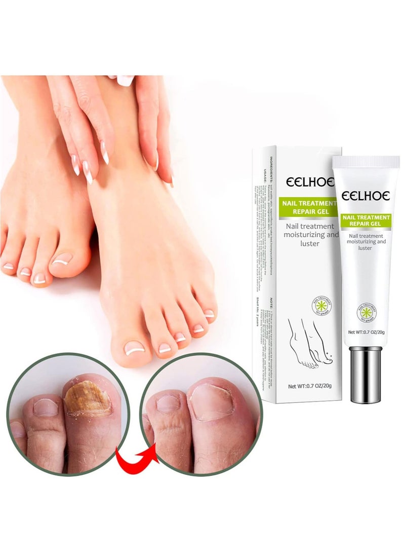 EELHOE Nail Repair Cream, Nail Repair Essence Gel Toe Be Health Instant Beauty Gel Toenail Treatment & Care Under the Nail Restores Appearance of Discolored or Damaged Nails - Image 4