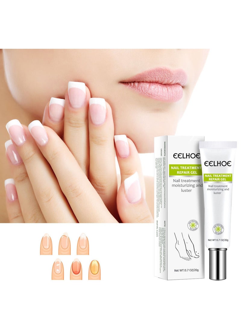EELHOE Nail Repair Cream, Nail Repair Essence Gel Toe Be Health Instant Beauty Gel Toenail Treatment & Care Under the Nail Restores Appearance of Discolored or Damaged Nails - Image 2
