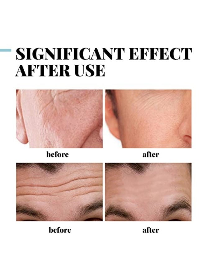 إيلهو كريم ريتينول للوجه للرجال مع فيتامين E وحمض الهيالورونيك – مضاد للتجاعيد، ترطيب عميق، شد وترطيب – كريم نهاري وليلّي لطيف لبشرة ناعمة وشابة – 30 مل - Image 3