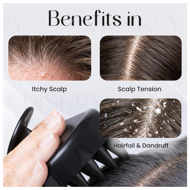 Episkey Scalp Massager Shampoo Brush for Hair Wash Anti-Dandruff Silicone Scalp Scrubber with Soft Bristles Deep Clean, Exfoliation & Hair Growth Ayurvedic Head Massage Brush for Men&Women(BLACK-35) - Image 3